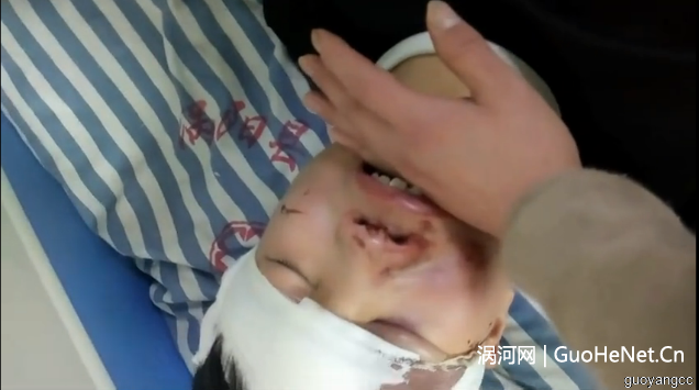 痛心！渦陽又一起學生墜樓，摔得滿臉是血，咋回事？ 